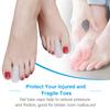White 10 Foot Sumifun Pairsbox Silicone Toe Cover Toe Valgus Overlapping Toe Cover Toe Correction Toe Protector Foot Care