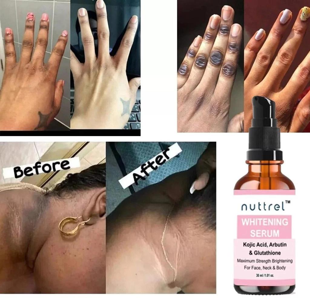 Multifunctional Facial Serum with Kojic Acid, Arbutin and Glutathione Dark Skin Whitening and Dark Spot Brightening 30ml