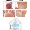 Chapped Feet & Feet Repair Cream Is Gentle and Non-irritating, Hydrating and Nourishing the Skin