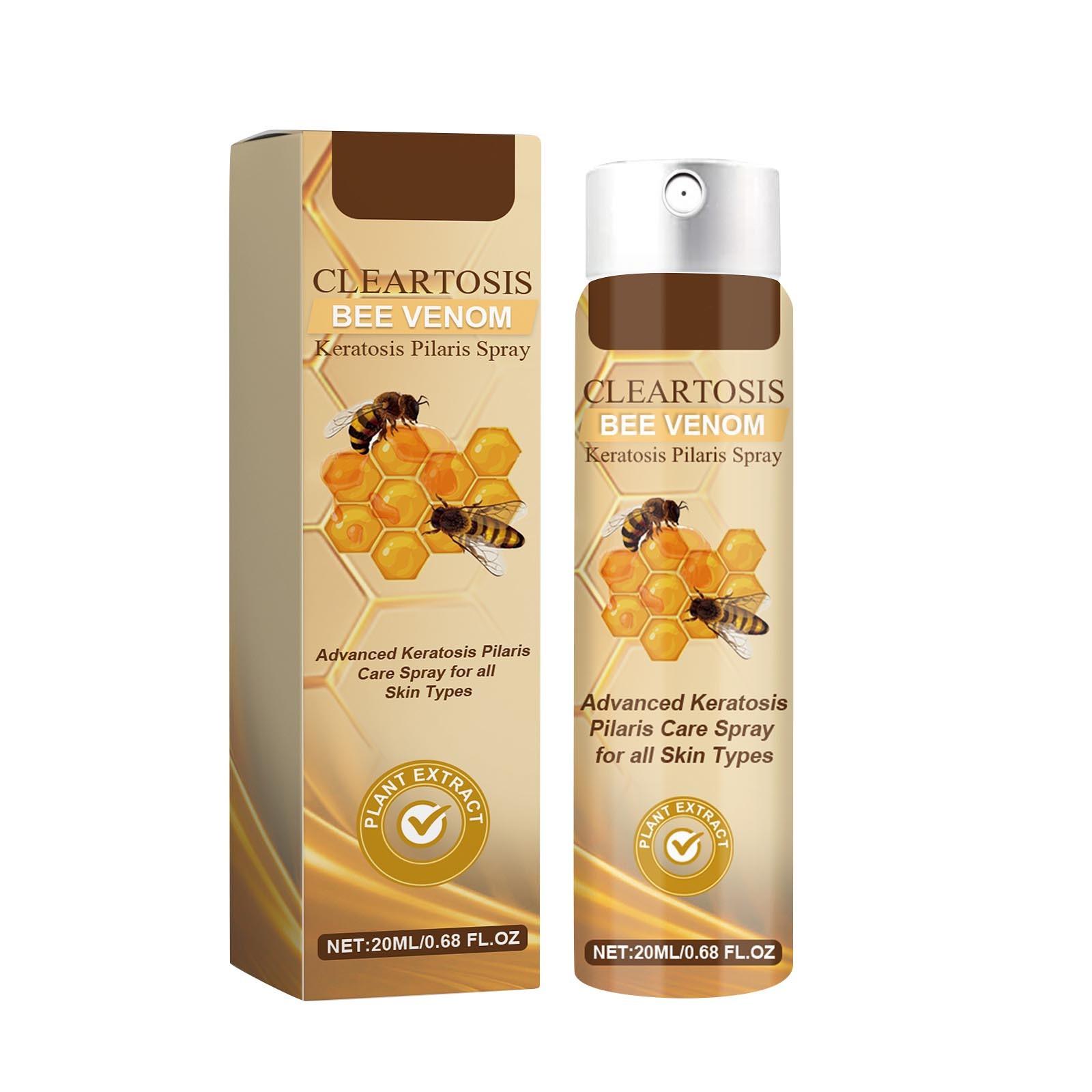 

Чистящий спрей для удаления прыщей на теле, для удаления прыщей на спине, шее, талии и уменьшения воспалений 20 мл, красота и уход за собой One Size