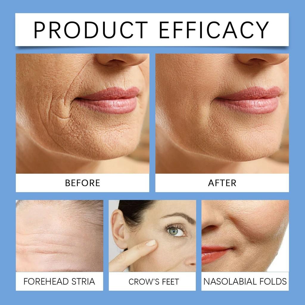 Esencia Facial de Colágeno West Month Serum Hidratante Humectante Fórmula Antienvejecimiento 30ml Para Piel Radiante