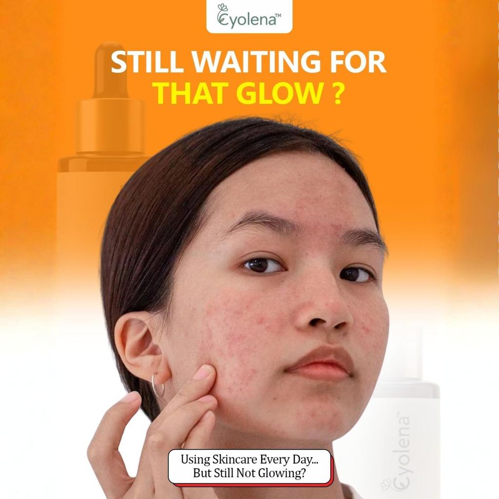 Cyolena Vitamin C Face Serum for Glowing Skin | With Vitamin E, Niacinamide & Hyaluronic Acid | Brightening, Hydrating & Skin Smoothing Serum for W