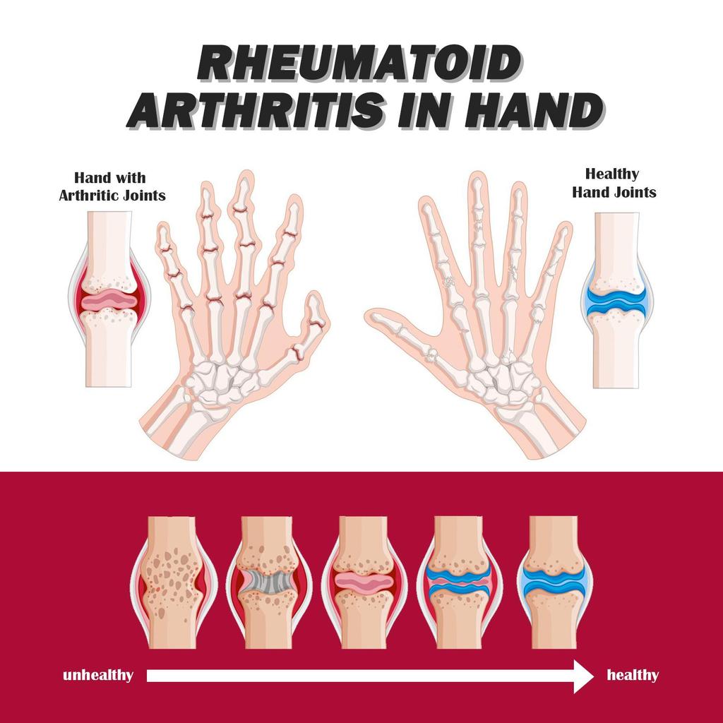 South Moon Collagen Cream for Joints and Bones Enhance bone injury recovery and recovery activities, and restore bone health.