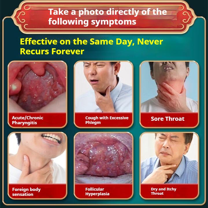 Plasture pentru faringită cronică faringită faringită plasture plat pentru acupunctură plasture pentru magnetoterapie