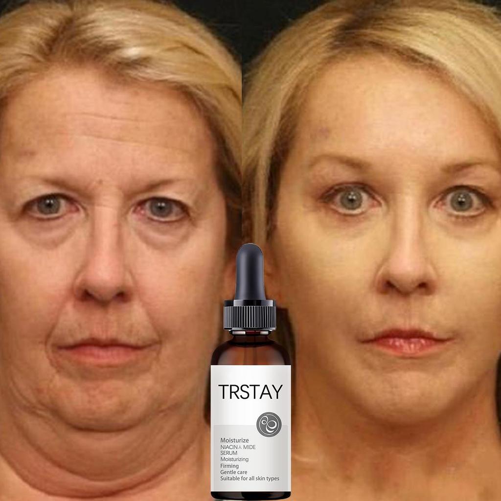 Turmeric Oil Facial Serum Anti-aging Remove Dark Spot Moisturizer Corrector Brighten Face Whitening Serum