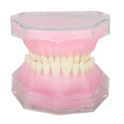 Tooth Model Resin Detachable Standard Study Teaching Implant Dental Mode for Teaching Practice
