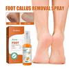 Nourishing Ouhoe Foot Spray For Softening Calluses And Cracked Heels 30ml