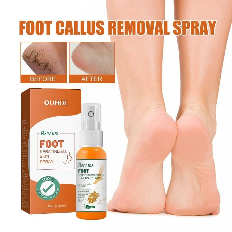 Nourishing Ouhoe Foot Spray For Softening Calluses And Cracked Heels 30ml