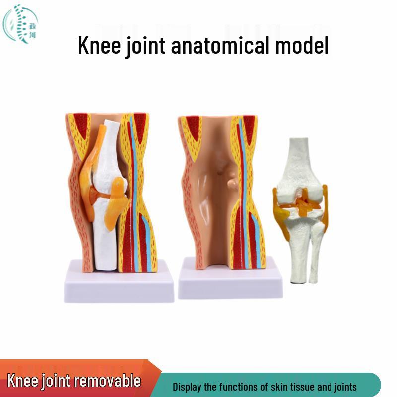 Removable Human Knee Joint Anatomy Model with Skin, Bones, Ligaments, and Meniscus for Medical Teaching