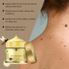 Verruca Care Cream Gentle Cleansing, Moisturizing And Softening The Skin, Reducing Skin Discomfort.