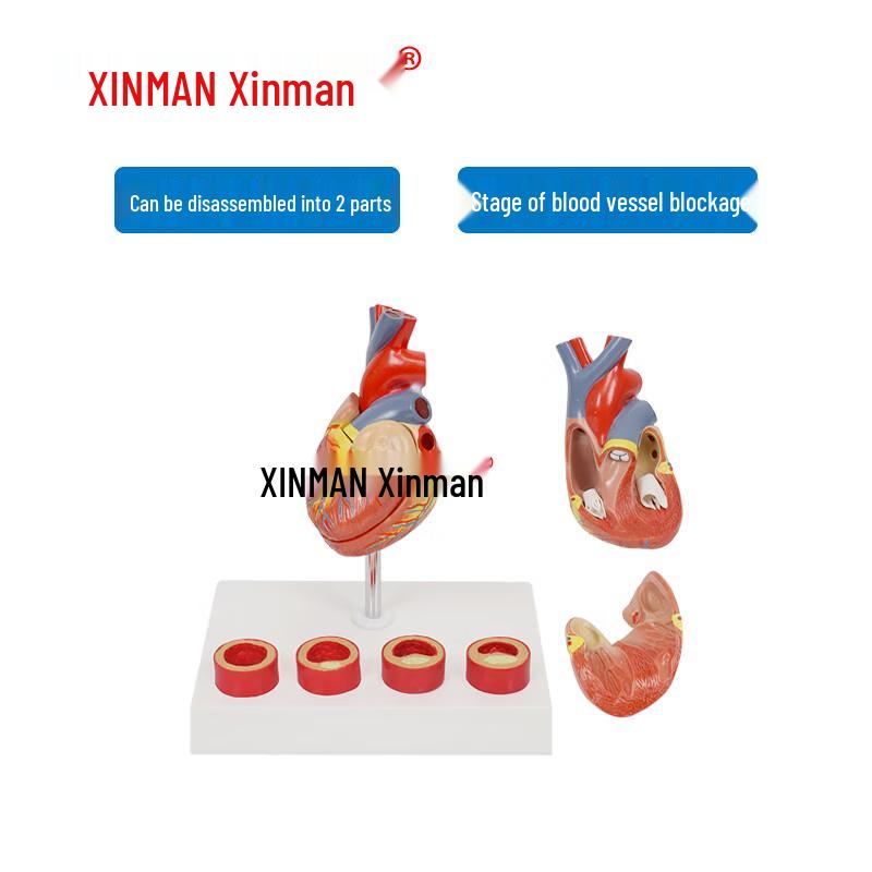Xinman Atherosclerosis with Thrombus Model