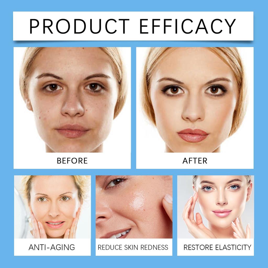 Ser de față cu niacinamidă Ser hidratant și hrănitor pentru iluminarea liniilor fine Ser pentru față hidratant fermitate(30ML)