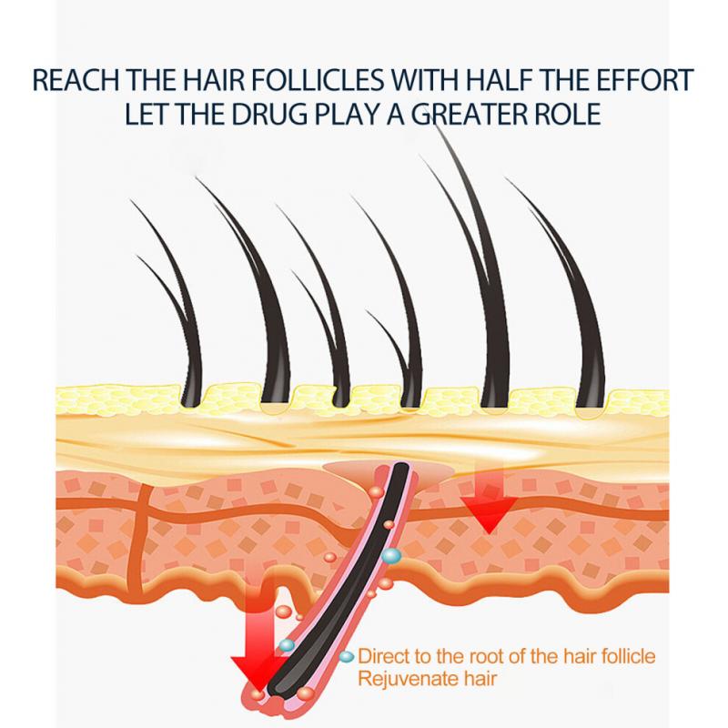 100ml Hair Growth Spray For Men and Women Hair Regrowth Treatment For Stronger Thicker Longer Hair