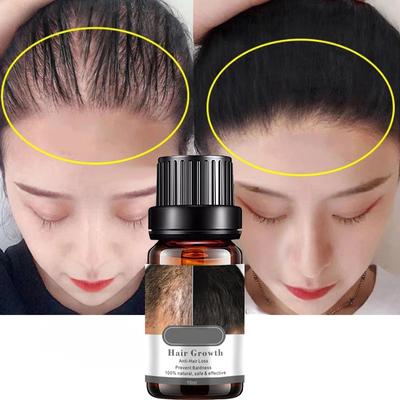 Óleo 10ml para crescimento capilar, soro capilar, produtos capilares, cuidados capilares