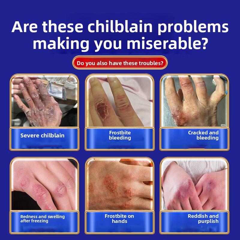 Soothing Salve for Rough Cracked Hands Feet & Frostnip - Natural Herbal Blend