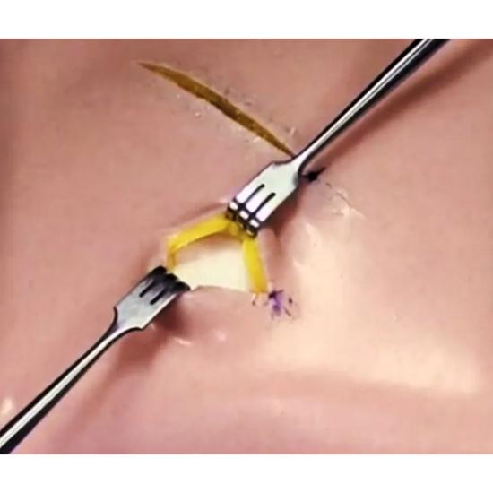 GDC Senn - Miller Scharfer Gewebehaken 16cm (Trsm1)