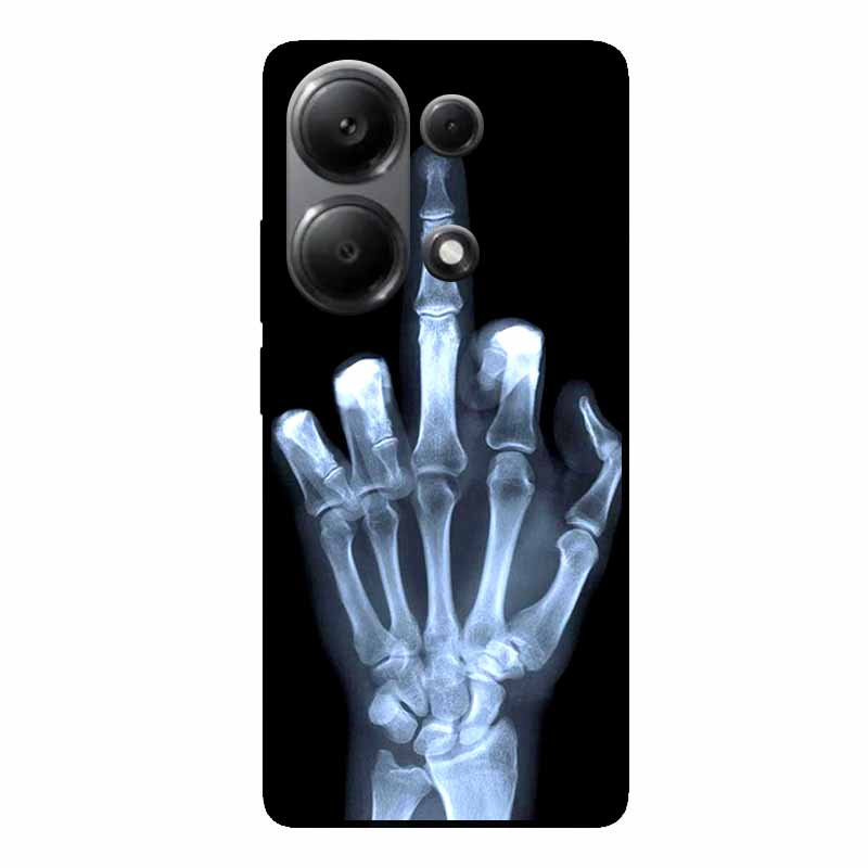 For Xiaomi Poco M6 Pro Cases Poco F6 Pro M6 4G 5G Poco X6 X5 PRO Black Soft TPU Silicone Phone Covers for Xiaomi Poco M6 5G 5G