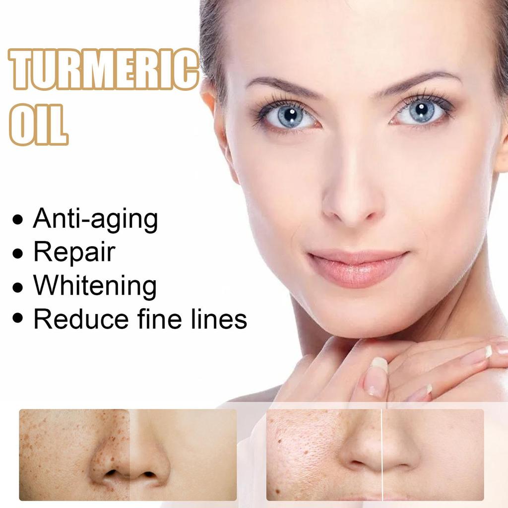 1/2/3/5pcs 30ml Turmeric Freckle Whitening Serum Curcumin Pigment Brighten Correcting Oil Spot B5C0