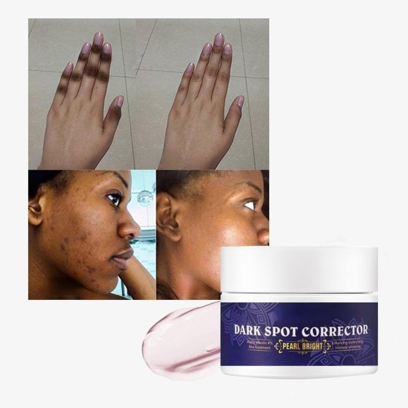 Removal 7 Days Dark Spot Corrector Skin Care Private Label Whitening Freckle Face Cream