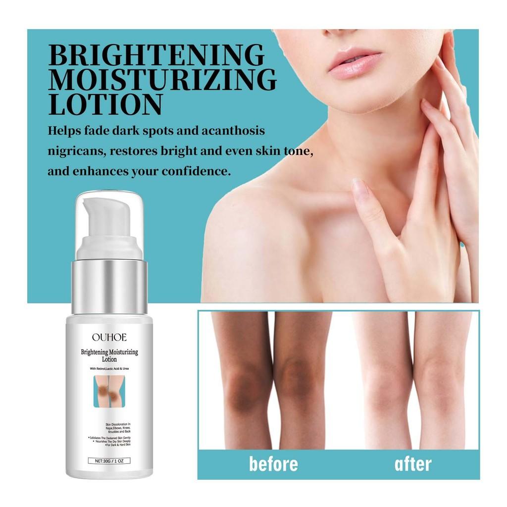 Ouhoe Nourishing Skin Whitening Cream For Underarms And Joints 30g Export Only