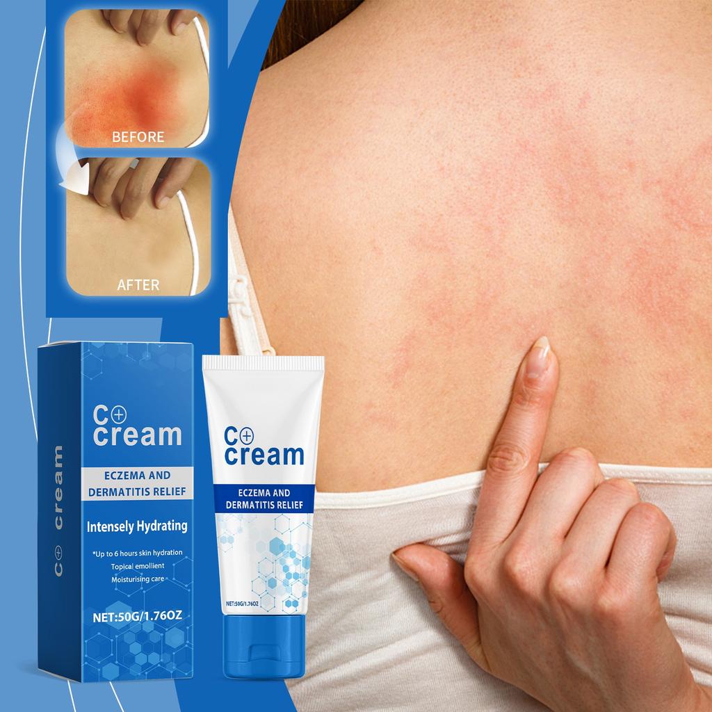 Multifunctional Care Cream Relieves Eczema And Skin Inflammation, Deeply Moisturizes The Skin And Promotes Skin Barrier