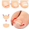 60Pcs Ingrown Paronychia Toenail Corrector Strips Anti Nail Patch Feet Sleeping Nail Patch Nails Into The Flesh Long Toe Pad