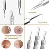 Ultra-fine Cell Pimples Blackhead Clip Tweezers Beauty Salon Remover Acne Needle Blackhead Deep Cleaner Clip Face Skin Care