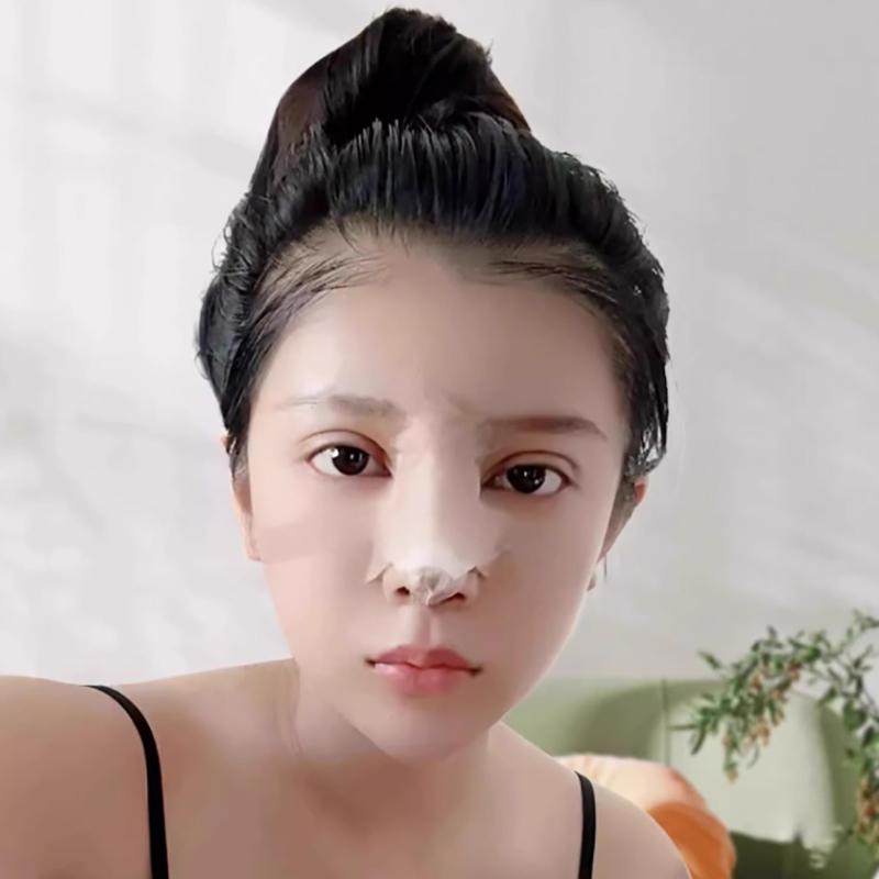 Reusable Low-Temperature Thermoplastic Nasal Splint – For Nose Bridge Shaping and Fracture Support