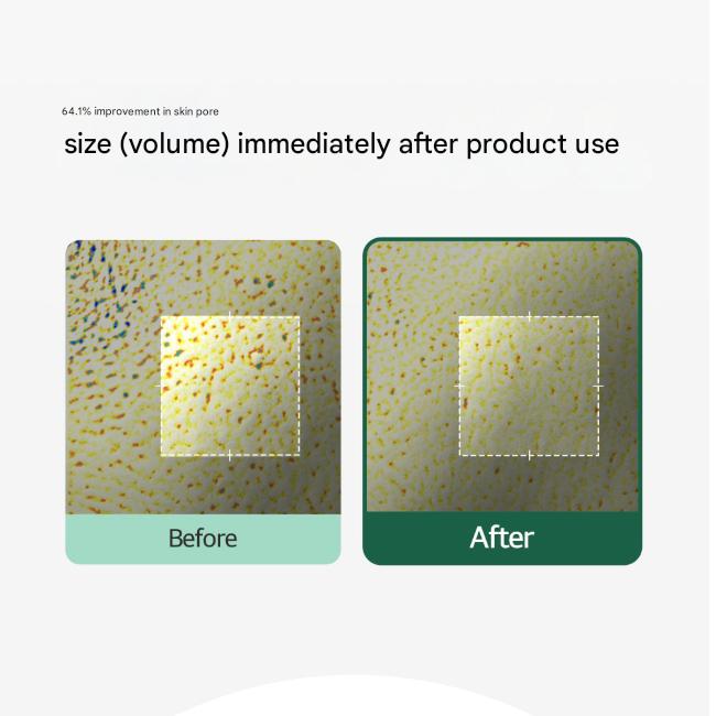 Ohui Prime Advancer PDRN Cooling Gel Pad (140ml / 70 Pads) (3 Options)