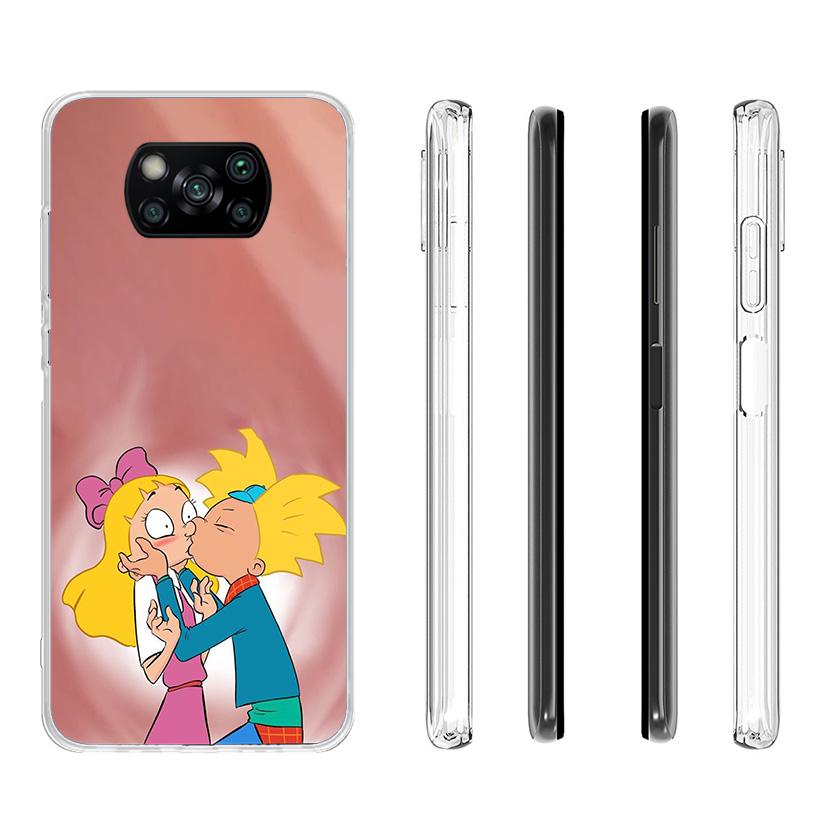 Cartoon Hey Arnold Fondos Phnoe Case for Xiaomi Poco X5 X6 X7 Pro X4 Gt F7 Ultra M8 M7 Redmi 15C 15 13C 13 12C 12 Unique Cover C