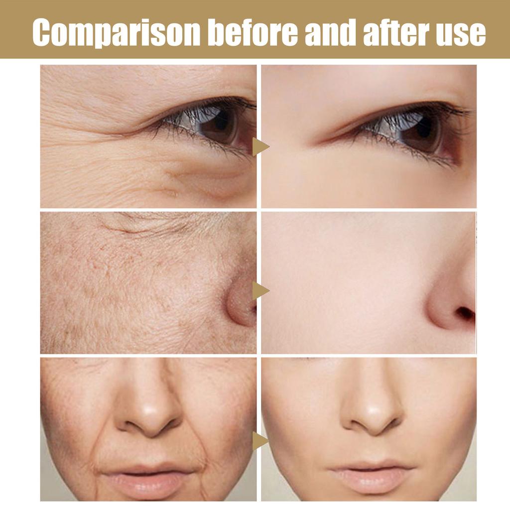 Eelhoe Retinol Vitamin E Night Facial Serum For Radiant Skin Hydrating Brightening Essence