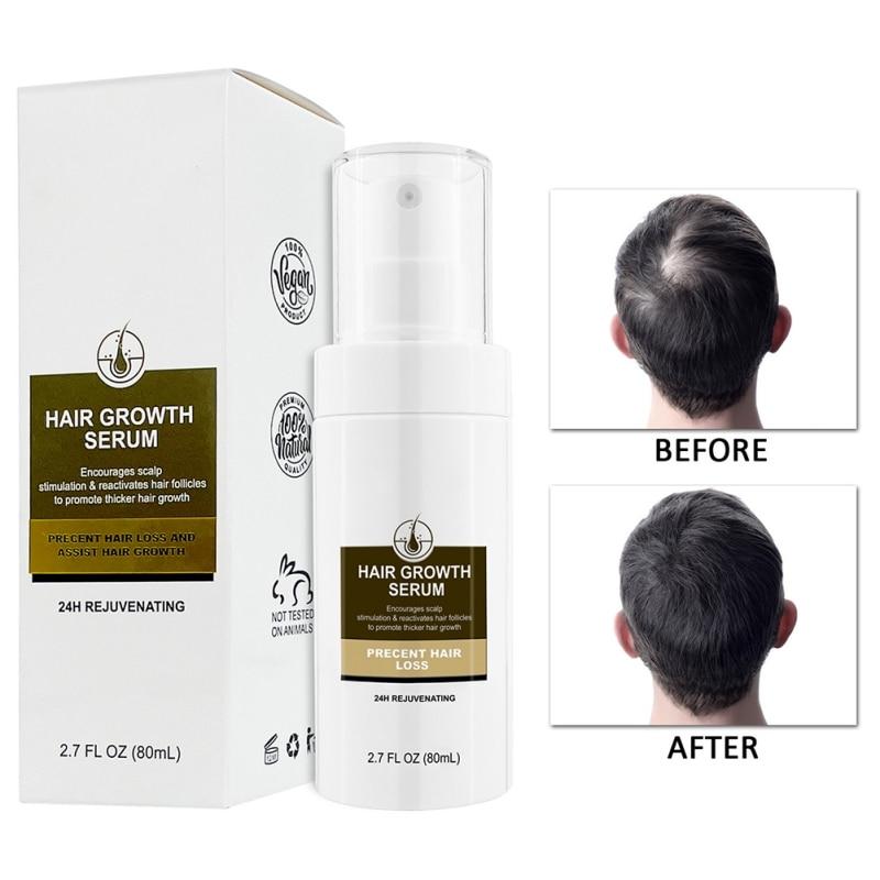 Buy 80ml Herbal Hair Regrowth Serum Natural Thickening Anti Hair Loss