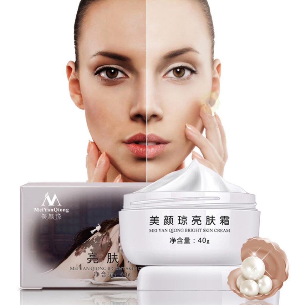 anti aging dark spot cream