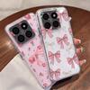 Pink Bowknots Floral Pattern Case For Xiaomi Redmi Note 15 Pro 4G Funda Redmi Note 14 13 Pro 5G Clear TPU Silicone Soft Cover
